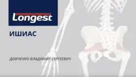 Защемление седалищного нерва. Острая фаза